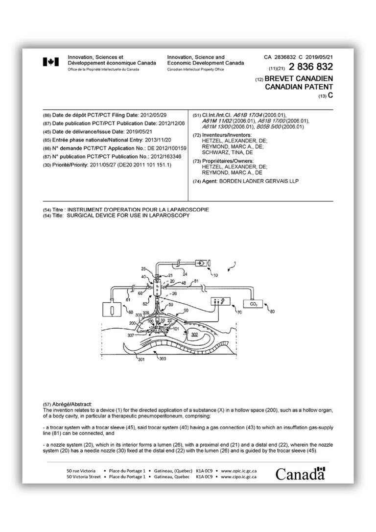 reger-patent-nebulizer-ca2836832c